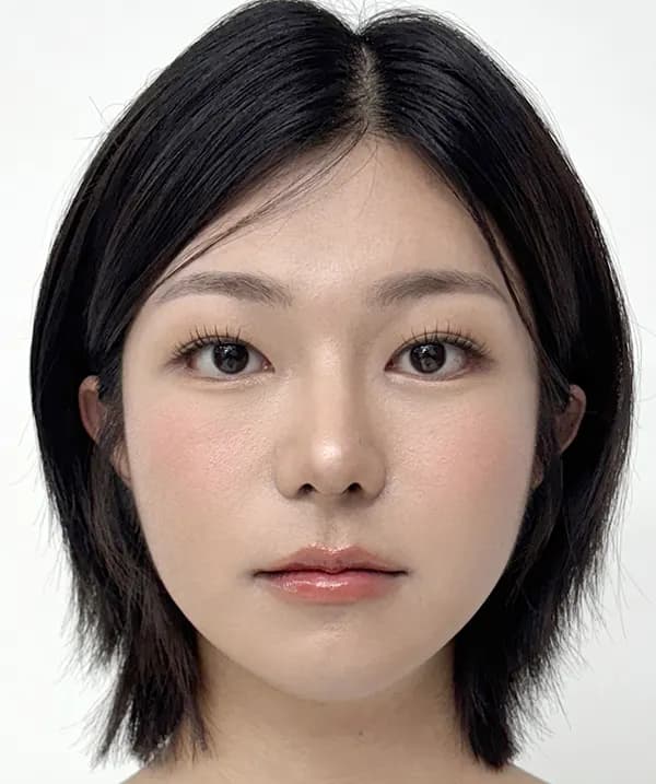 Before and after surgery front view