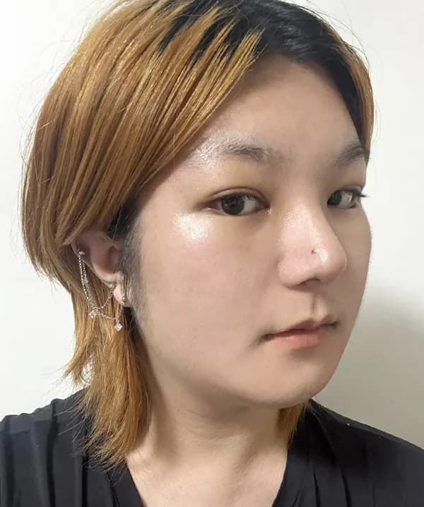 Before and after surgery side view