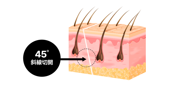 AB’s Key feature