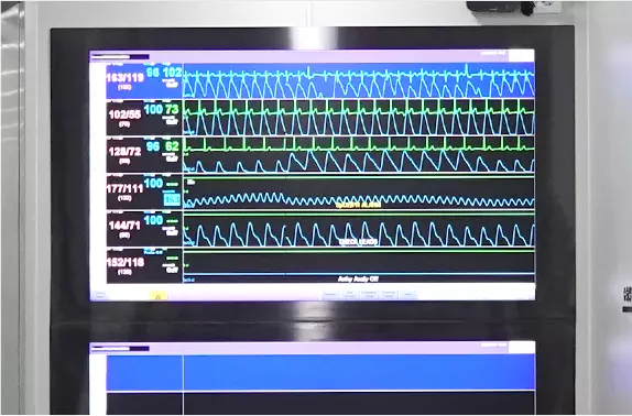 中央感知システム