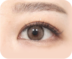 眼瞼下垂がある場合