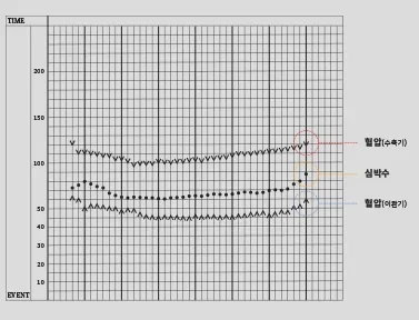 麻酔中から術後まで患者様の状態をリアルタイムで確認し、緊急時にも迅速に対応