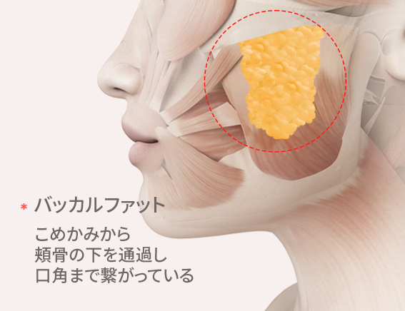 もっとシャープに、バッカルファット除去