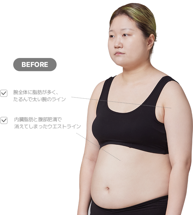 맥미걸 악플콜렉터 바디 수술 전 문제점과 개선점