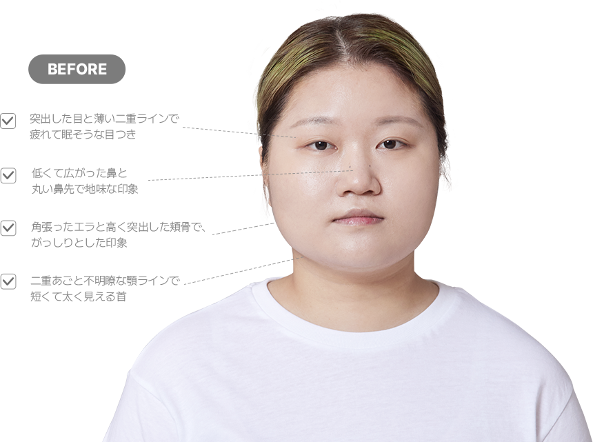 맥미걸 악플콜렉터 얼굴 수술 전 문제점과 개선점