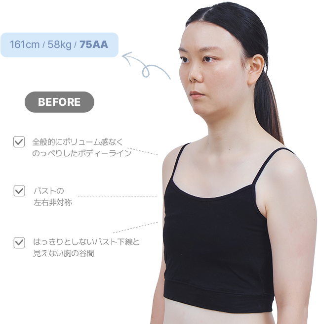 맥미걸 악플콜렉터 바디 수술 전 문제점과 개선점