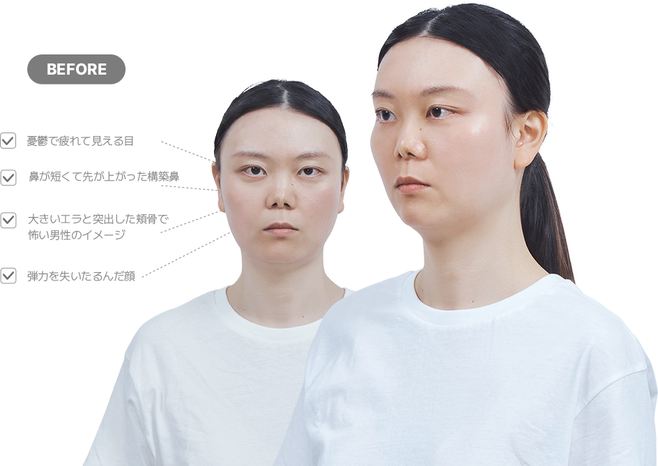 맥미걸 악플콜렉터 얼굴 수술 전 문제점과 개선점