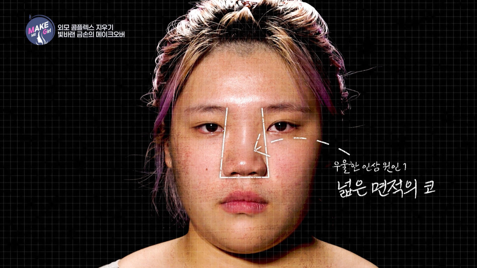 맥미걸 MAKE ME GIRL 수술 전