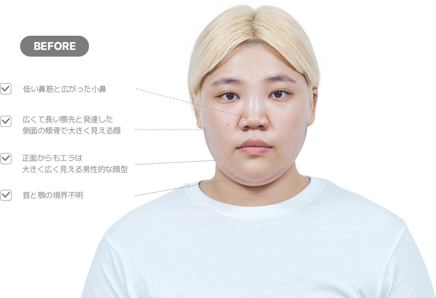 맥미걸 악플콜렉터 얼굴 수술 전 문제점과 개선점