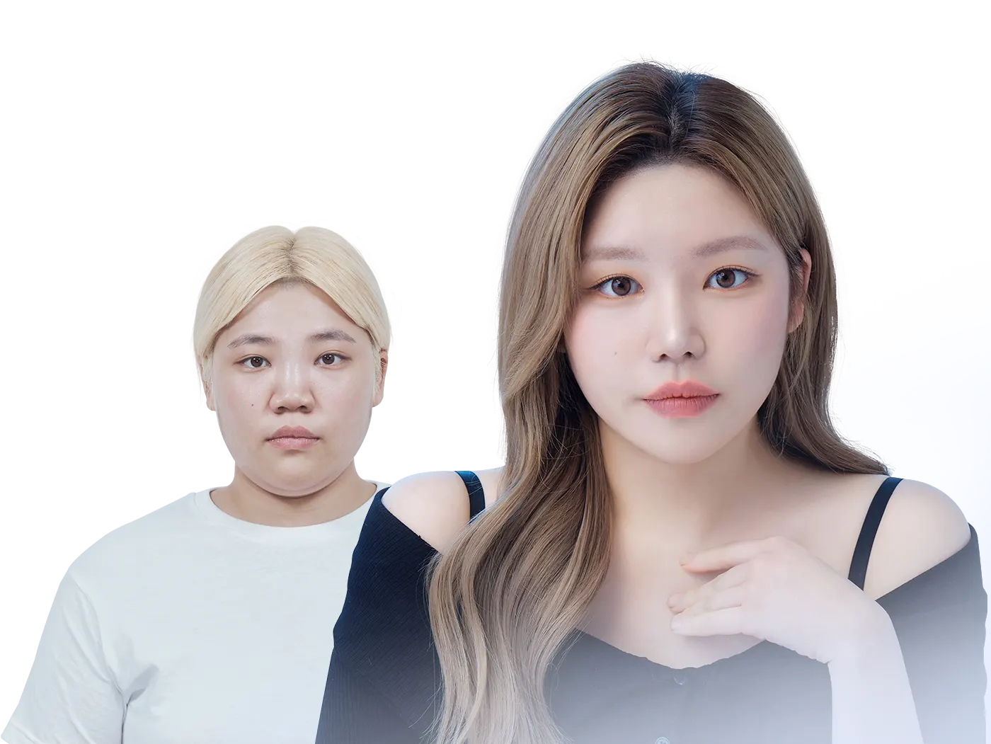 맥미걸 악플콜렉터 수술 전후 사진