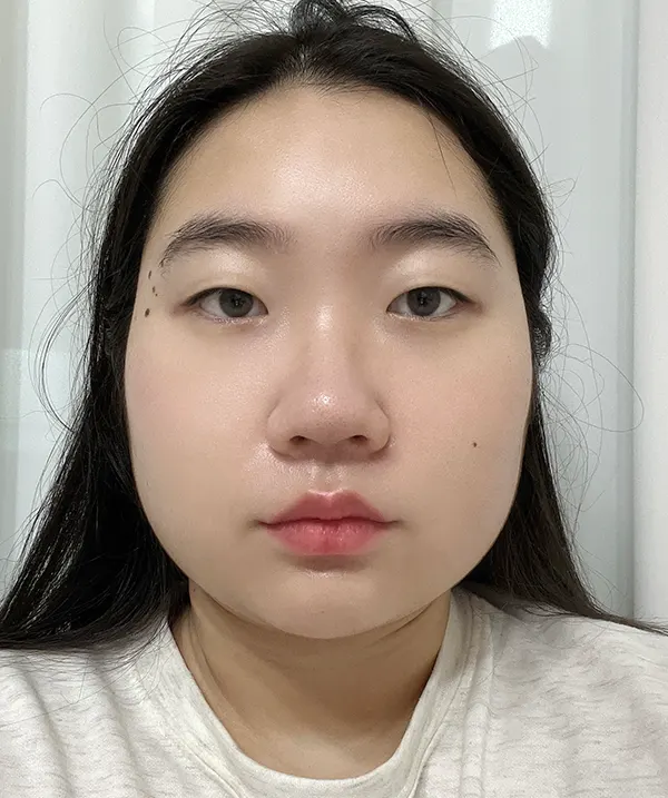 맥미걸 악플콜렉터 Before후 사진