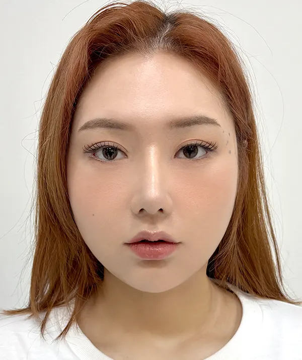 맥미걸 악플콜렉터 Before후 사진