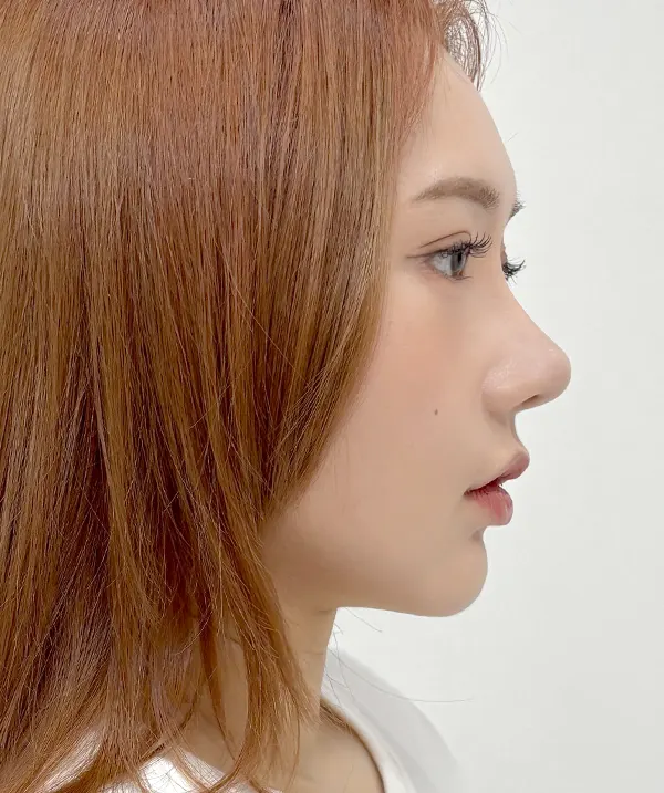 맥미걸 악플콜렉터 Before후 사진