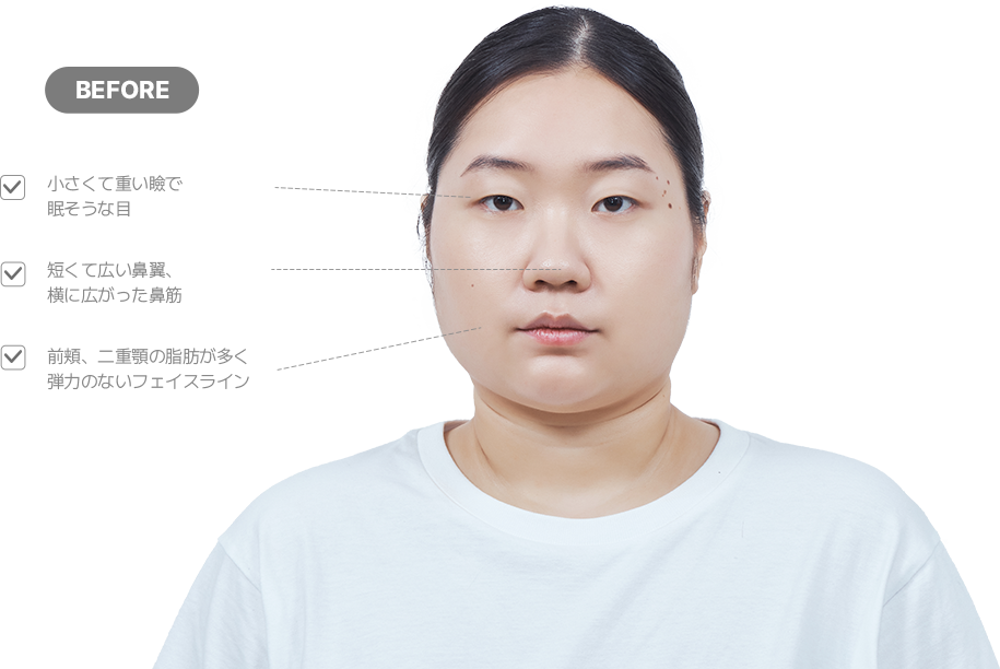 맥미걸 악플콜렉터 얼굴 수술 전 문제점과 개선점