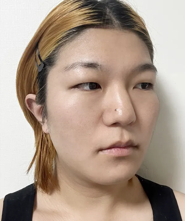 맥미걸 악플콜렉터 Before후 사진