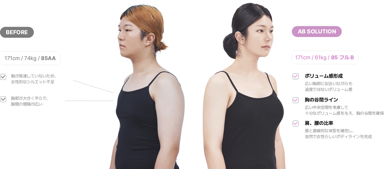 맥미걸 악플콜렉터 얼굴 수술 전 문제점과 개선점