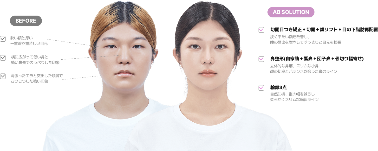 맥미걸 악플콜렉터 얼굴 수술 전 문제점과 개선점