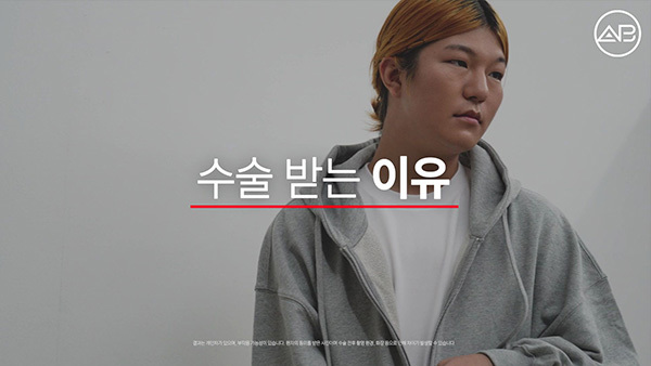 맥미걸 MAKE ME GIRL 수술 전