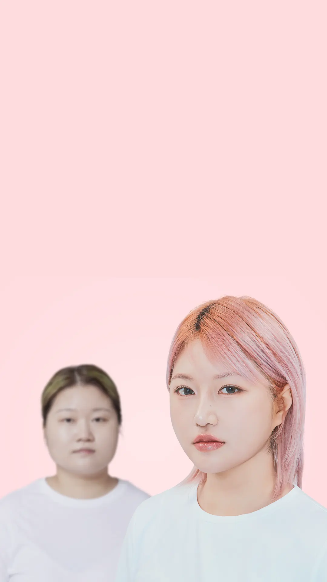 맥미걸 악플콜렉터 수술 전후 사진