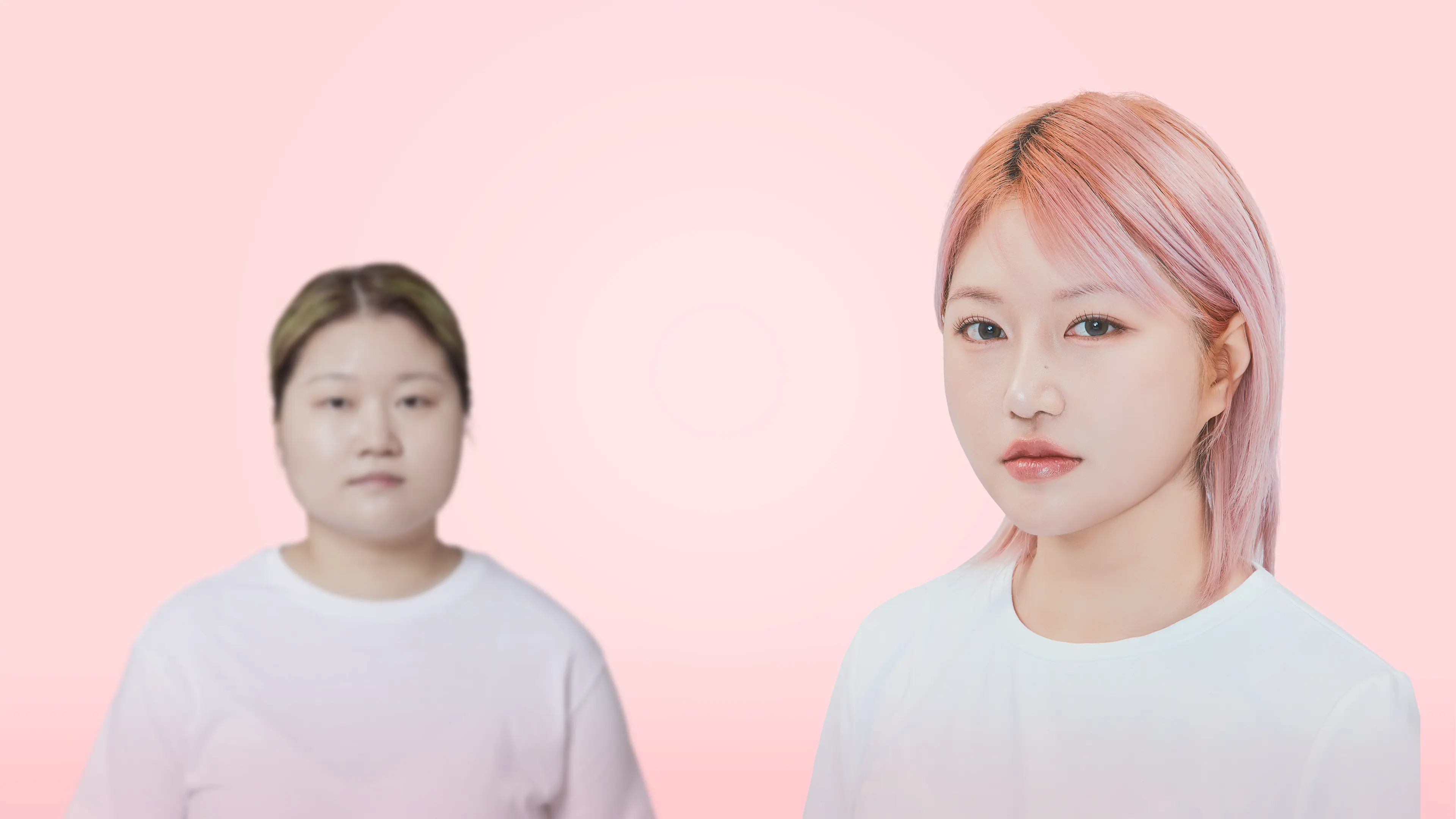 맥미걸 악플콜렉터 수술 전후 사진