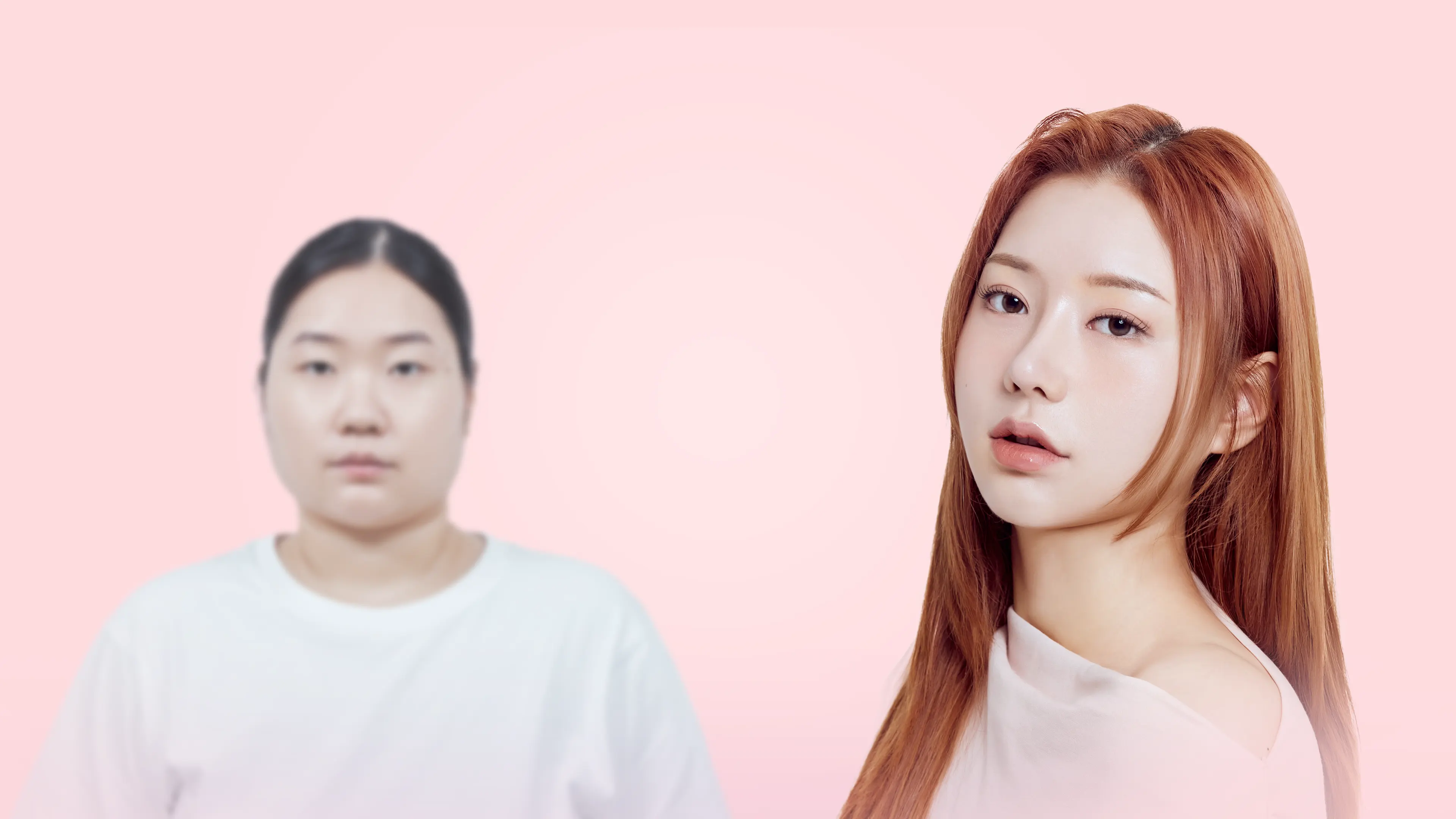 맥미걸 맥미돌 수술 전후 사진