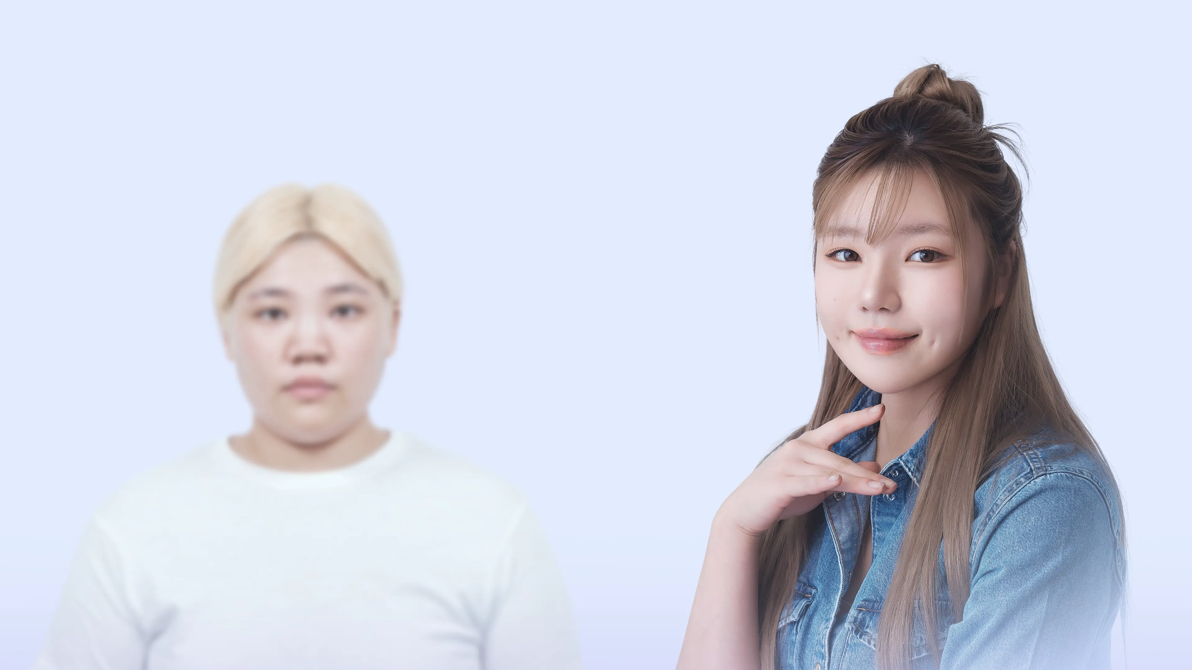 맥미걸 각진인생 수술 전후 사진