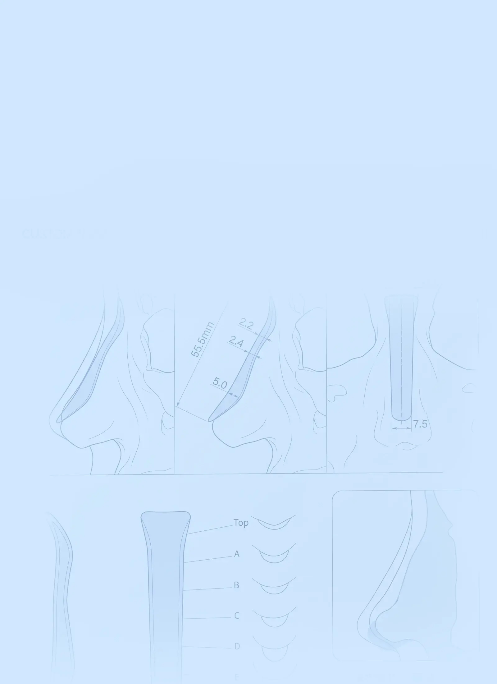 Sofit Nose