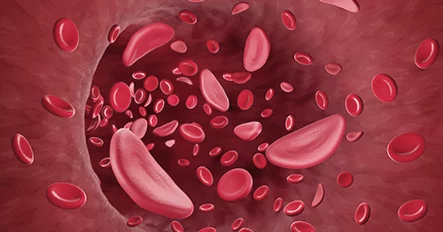 血液幹細胞注射