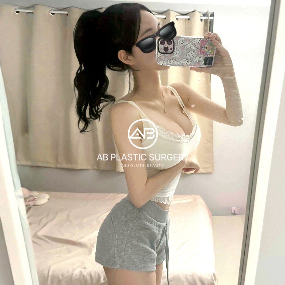 韓国豊胸リアルレビュー写真|AB美容外科で施術を受けた患者のセルフィー。自然なバストラインと全身バランスを確認可能