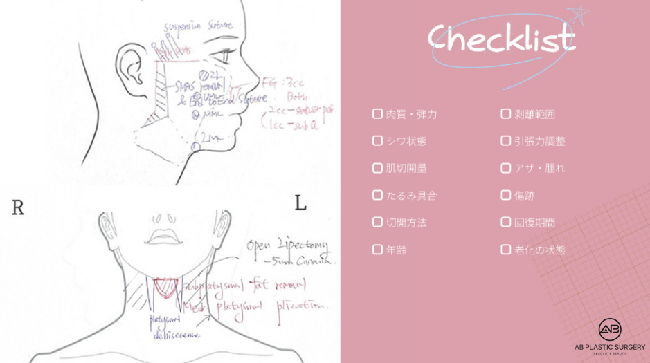 フルリフト 手術デザインとチェックリスト