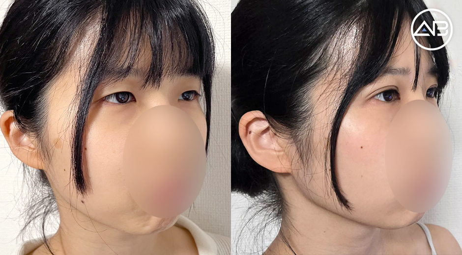 AB Plastic Surgery