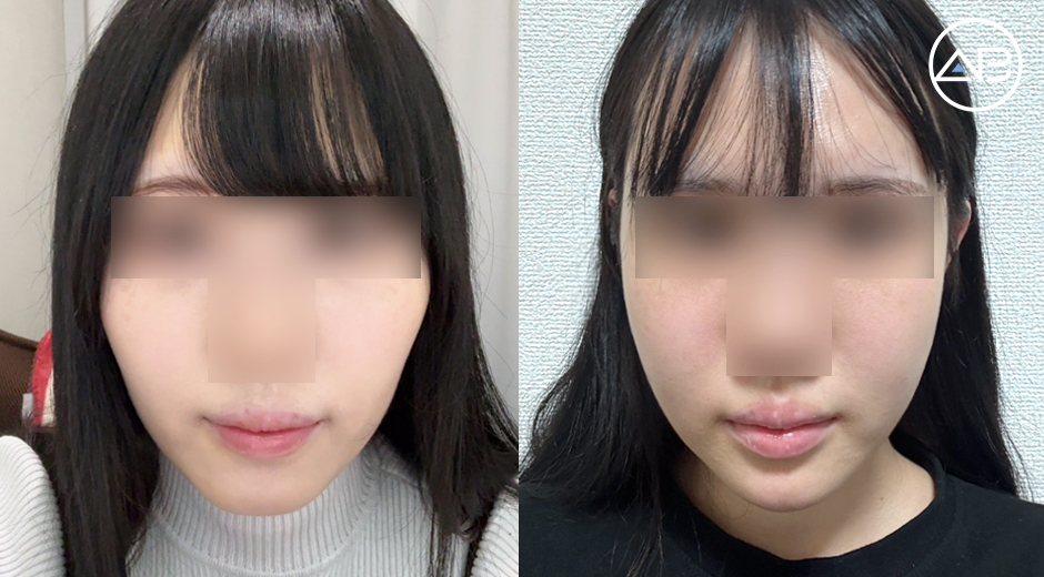 AB Plastic Surgery